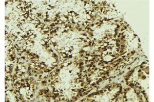 ABIN6273273 at 1/100 staining Human lung tissue by IHC-P. (NFKBIZ antibody  (Internal Region))