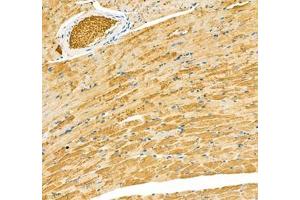 Immunohistochemistry of paraffin embedded mouse heart using Sarcomeric α Actinin (ABIN7075510) at dilution of 1: 1000 (200x lens) (Sarcomeric alpha Actinin antibody)