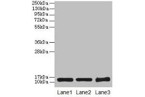 Western blot All lanes: SNCG antibody at 16 μg/mL Lane 1: HT29 whole cell lysate Lane 2: Mouse brain tissue Lane 3: 293T whole cell lysate Secondary Goat polyclonal to rabbit IgG at 1/10000 dilution Predicted band size: 14 kDa Observed band size: 14 kDa (SNCG antibody  (AA 1-127))