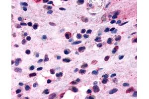 Immunohistochemistry (IHC) image for anti-Prostaglandin D2 Receptor 2 (PTGDR2) (Extracellular Domain) antibody (ABIN1048827)