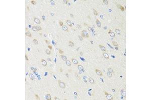 Immunohistochemistry of paraffin-embedded rat brain using CRABP2 antibody. (CRABP2 antibody  (AA 22-94))