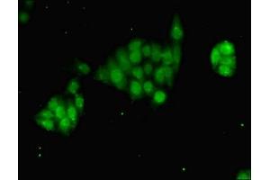 Immunofluorescent analysis of PC-3 cells using ABIN7172662 at dilution of 1:100 and Alexa Fluor 488-congugated AffiniPure Goat Anti-Rabbit IgG(H+L) (GTF2B antibody  (AA 1-316))