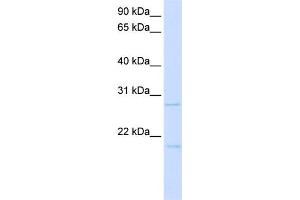 WB Suggested Anti-TCF21 Antibody Titration:  0. (TCF21 antibody  (C-Term))