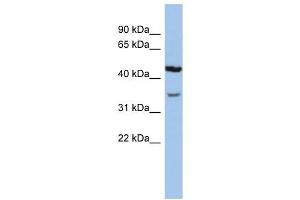 KCNK4 antibody used at 1 ug/ml to detect target protein.