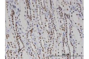Image no. 1 for anti-DEAD/H (Asp-Glu-Ala-Asp/His) Box Polypeptide 11 (DDX11) (AA 1-970) antibody (ABIN599369) (DDX11 antibody  (AA 1-970))