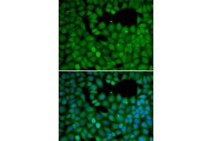 Immunofluorescence analysis of HeLa cells using NET1 antibody (ABIN5970555).