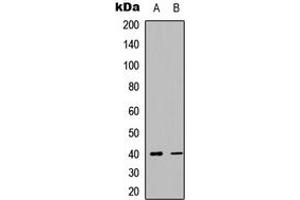 Western blot analysis of CD184 expression in HeLa (A), mouse brain (B) whole cell lysates. (CXCR4 antibody  (C-Term))
