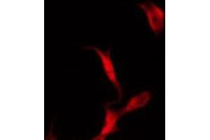 ABIN6272291 staining COLO205 by IF/ICC. (KIF11 antibody  (C-Term))