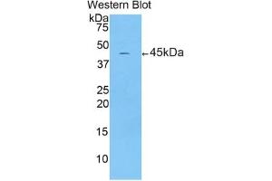 Detection of Recombinant CRH, Human using Polyclonal Antibody to Corticotropin Releasing Factor (CRF) (CRH antibody  (AA 40-195))