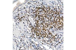Immunohistochemistry (IHC) image for anti-IKAROS Family Zinc Finger 3 (Aiolos) (IKZF3) antibody (ABIN7267842)