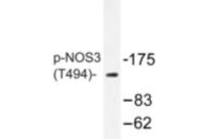 Image no. 1 for anti-Nitric Oxide Synthase 3 (Endothelial Cell) (NOS3) (pThr494) antibody (ABIN318323)