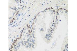 Immunohistochemistry of paraffin-embedded Human prostate using MDC1 Polyclonal Antibody at dilution of 1:100 (40x lens). (MDC1 antibody)