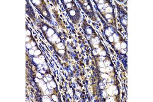Immunohistochemistry of paraffin-embedded rat ileum using ARID3A antibody (ABIN5975618) at dilution of 1/100 (40x lens). (ARID3A antibody)