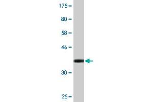 Western Blot detection against Immunogen (36. (RBM12 antibody  (AA 834-932))