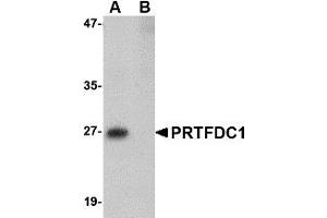 Western Blotting (WB) image for anti-phosphoribosyl Transferase Domain Containing 1 (PRTFDC1) (Middle Region) antibody (ABIN1031049) (PRTFDC1 antibody  (Middle Region))