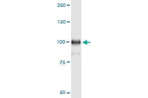 Immunoprecipitation of HOOK1 transfected lysate using anti-HOOK1 MaxPab rabbit polyclonal antibody and Protein A Magnetic Bead , and immunoblotted with HOOK1 purified MaxPab mouse polyclonal antibody (B01P) . (HOOK1 antibody  (AA 1-728))