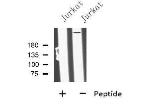 Western blot analysis of MIA3 using Jurkat whole cell lysates (MIA3 antibody  (C-Term))