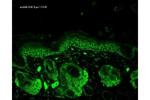 Immunohistochemistry analysis using Rabbit Anti-SOD2 Polyclonal Antibody . (SOD2 antibody  (PE))