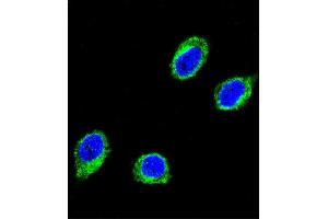 Confocal immunofluorescent analysis of CCHCR1 Antibody (Center) (ABIN652467 and ABIN2842318) with 293 cell followed by Alexa Fluor® 488-conjugated goat anti-rabbit lgG (green). (CCHCR1 antibody  (AA 599-627))