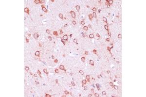 Immunohistochemistry of paraffin-embedded rat brain using RPL21 antibody (ABIN7269996) at dilution of 1:100 (40x lens). (RPL21 antibody  (AA 1-160))