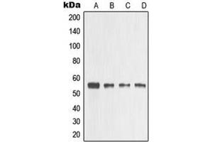 Western blot analysis of MMP3 expression in HeLa (A), A431 (B), mouse heart (C), PC12 (D) whole cell lysates.