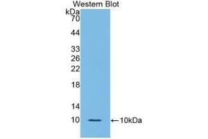 Detection of Recombinant IL6R, Rat using Polyclonal Antibody to Interleukin 6 Receptor (IL6R) (IL-6 Receptor antibody  (AA 385-462))