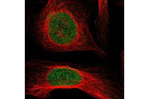Immunofluorescent staining of U-2 OS cells using KAT5 polyclonal antibody  shows positivity in nucleus (green) but excluded from the nucleoli. (KAT5 antibody  (AA 150-286))