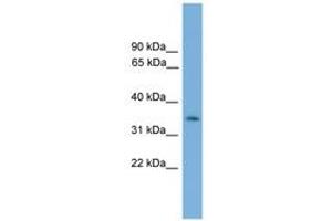 Image no. 1 for anti-NK3 Homeobox 2 (NKX3-2) (AA 151-200) antibody (ABIN6744516) (NKX3-2 antibody  (AA 151-200))