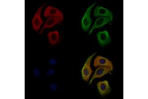 ABIN6264436 and ABIN6276677 staining Hela cells by IF/ICC.