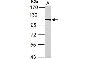 WB Image alpha Actinin 4 antibody [N2C1], Internal detects alpha Actinin 4 protein by Western blot analysis. (alpha Actinin 4 antibody)