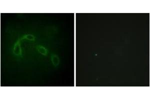 Immunofluorescence analysis of HeLa cells, using PAK1/2 (Ab-199) Antibody. (PAK1/2 antibody  (AA 165-214))