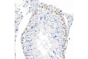 Immunohistochemistry of paraffin-embedded mouse liver using Phospho--S473 Rabbit mAb (ABIN6135179, ABIN6135970, ABIN6135971 and ABIN7101880) at dilution of 1:100 (40x lens). (AKT1 antibody  (pSer473))