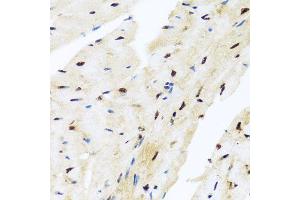 Immunohistochemistry of paraffin-embedded mouse heart using ZBTB17 antibody (ABIN5974597) at dilution of 1/100 (40x lens). (ZBTB17 antibody)