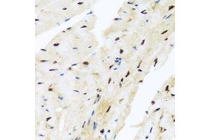 Immunohistochemistry of paraffin-embedded mouse heart using ZBTB17 antibody (ABIN5974597) at dilution of 1/100 (40x lens). (ZBTB17 antibody)