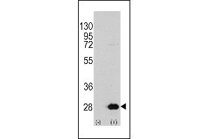 Western blot analysis of HSPB1 (arrow) using rabbit polyclonal HSPB1 Antibody (S78) (R). (HSP27 antibody  (AA 56-85))