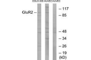 Western blot analysis of extracts from COLO205/HuvEC cells, using GluR2 (Ab-880) Antibody. (GRIA2 antibody  (AA 834-883))