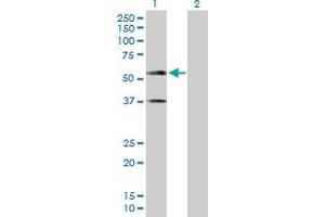 Western Blot analysis of CADM1 expression in transfected 293T cell line by CADM1 MaxPab polyclonal antibody. (CADM1 antibody  (AA 1-387))