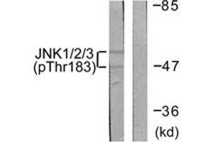 Western blot analysis of extracts from 293 cells treated with UV 5', using JNK1/2/3 (Phospho-Thr183+Tyr185) Antibody.