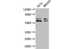 Western Blot Positive WB detected in: Hela whole cell lysate, HEK293 whole cell lysate All lanes: COASY antibody at 3. (COASY antibody  (AA 453-546))