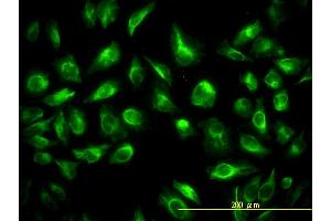 Immunofluorescence of monoclonal antibody to TES on HeLa cell.