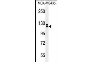 TTLL13 Antibody (Center) (ABIN655432 and ABIN2844968) western blot analysis in MDA-M cell line lysates (35 μg/lane). (TTLL13 antibody  (AA 461-490))