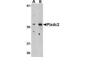 Western Blotting (WB) image for anti-Plexin Domain Containing 2 (PLXDC2) (N-Term) antibody (ABIN1031520) (PLXDC2 antibody  (N-Term))