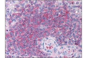 Immunohistochemistry (IHC) image for anti-5-Aminoimidazole-4-Carboxamide Ribonucleotide Formyltransferase/IMP Cyclohydrolase (ATIC) antibody (ABIN264511) (ATIC antibody)