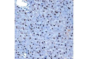 Immunohistochemistry (IHC) image for anti-N-Acetyltransferase 10 (GCN5-Related) (NAT10) antibody (ABIN7268774)