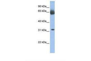 Image no. 1 for anti-Chromosome 11 Open Reading Frame 54 (C11orf54) (AA 38-87) antibody (ABIN6737987)