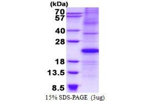Image no. 1 for Cyclin-Dependent Kinase Inhibitor 1A (p21, Cip1) (CDKN1A) protein (His tag) (ABIN1098681)