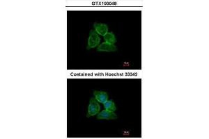 ICC/IF Image Immunofluorescence analysis of methanol-fixed A431, using Annexin A13, antibody at 1:500 dilution. (Annexin A13 antibody  (N-Term))
