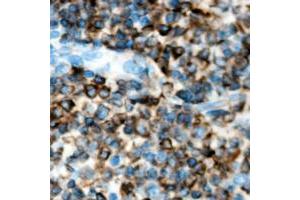 Immunohistochemical analysis of ACVR1B staining in human lymph node formalin fixed paraffin embedded tissue section.