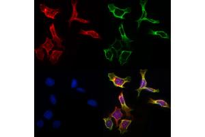 ABIN6261451 and ABIN6266860 staining Hela by IF/ICC. (Ephrin A5 antibody  (Internal Region))
