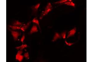 Immunofluorescence (fixed cells) (IF/ICC) image for anti-Inhibitor of kappa Light Polypeptide Gene Enhancer in B-Cells, Kinase gamma (IKBKG) (N-Term) antibody (ABIN6262516)